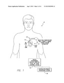 SYSTEMS AND METHODS FOR TRACKING STROKE VOLUME USING HYBRID IMPEDANCE     CONFIGURATIONS EMPLOYING A MULTI-POLE IMPLANTABLE CARDIAC LEAD diagram and image