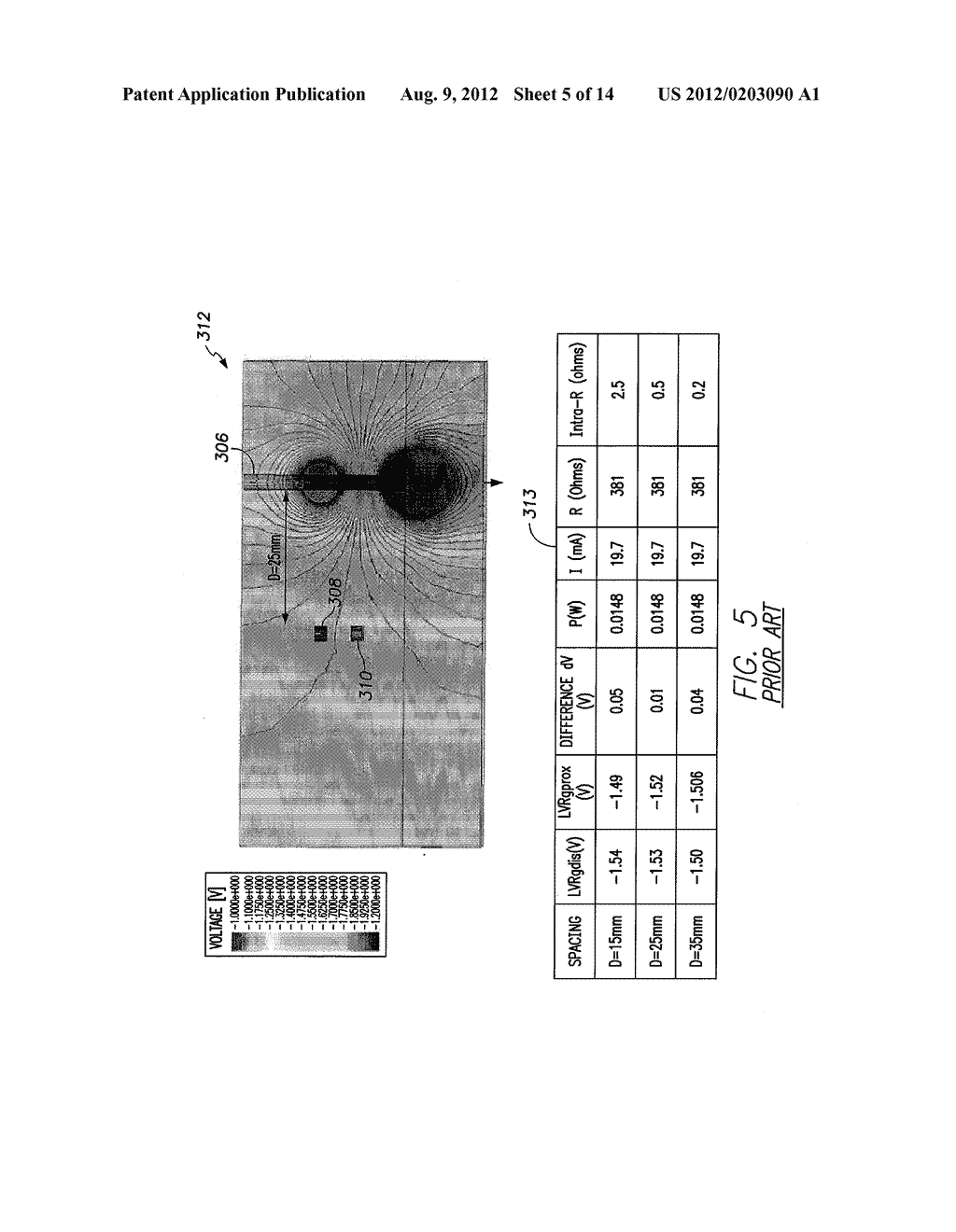 SYSTEMS AND METHODS FOR TRACKING STROKE VOLUME USING HYBRID IMPEDANCE     CONFIGURATIONS EMPLOYING A MULTI-POLE IMPLANTABLE CARDIAC LEAD - diagram, schematic, and image 06