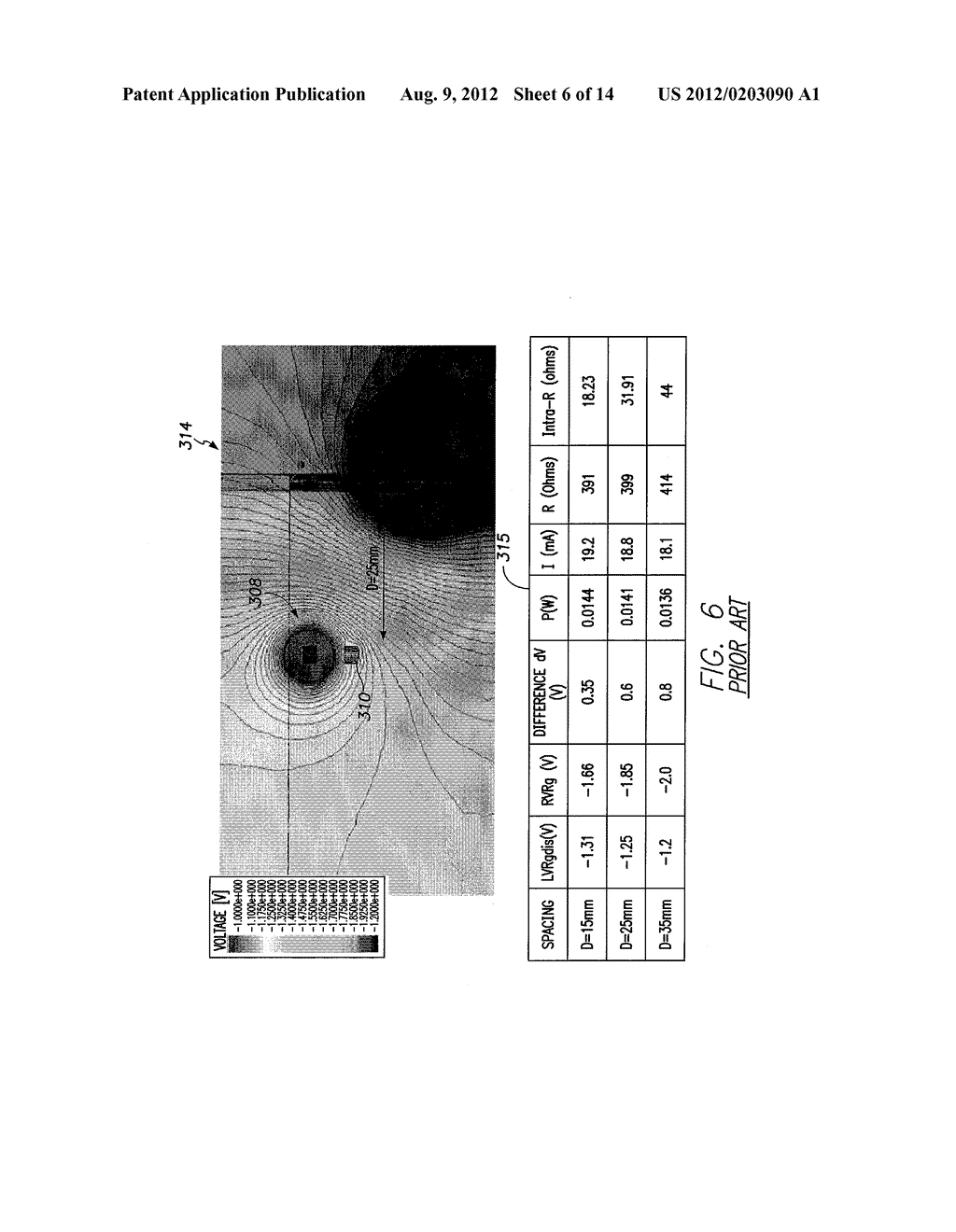 SYSTEMS AND METHODS FOR TRACKING STROKE VOLUME USING HYBRID IMPEDANCE     CONFIGURATIONS EMPLOYING A MULTI-POLE IMPLANTABLE CARDIAC LEAD - diagram, schematic, and image 07