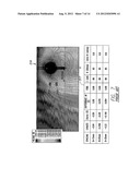 SYSTEMS AND METHODS FOR TRACKING STROKE VOLUME USING HYBRID IMPEDANCE     CONFIGURATIONS EMPLOYING A MULTI-POLE IMPLANTABLE CARDIAC LEAD diagram and image