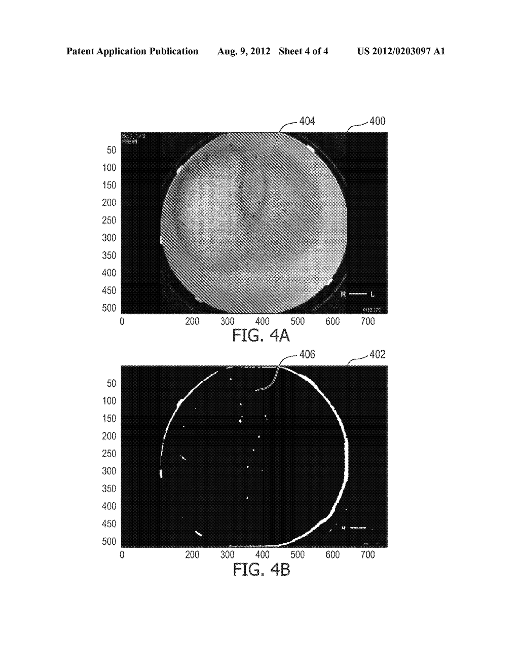 MAGNETIC RESONANCE IMAGING SYSTEM AND METHOD FOR DETECTING A GAS BUBBLE - diagram, schematic, and image 05