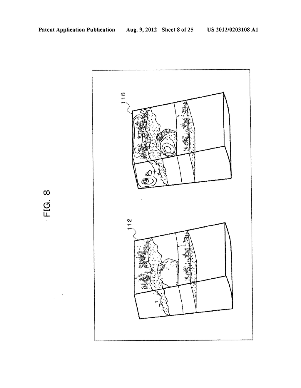 ULTRASONIC DIAGNOSTIC APPARATUS AND IMAGE CONSTRUCTION METHOD - diagram, schematic, and image 09