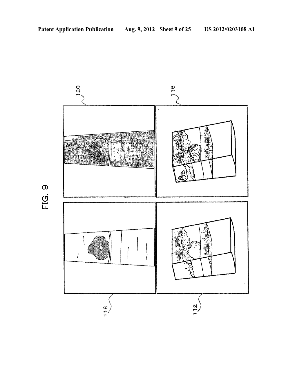 ULTRASONIC DIAGNOSTIC APPARATUS AND IMAGE CONSTRUCTION METHOD - diagram, schematic, and image 10