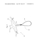 NASAL CANNULA WITH INTEGRATED THERMAL FLOW SENSING diagram and image