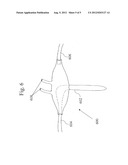 NASAL CANNULA WITH INTEGRATED THERMAL FLOW SENSING diagram and image