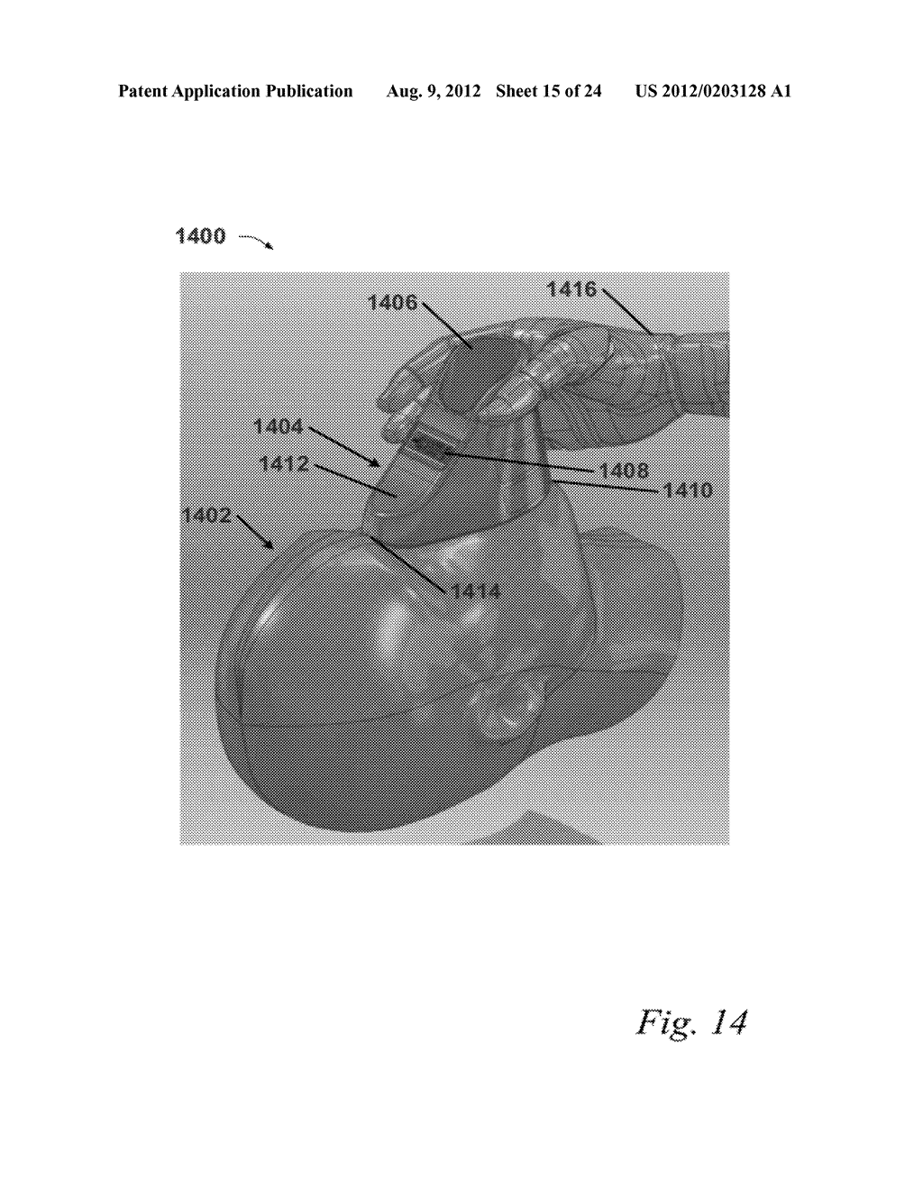 RESPIRATORY RATE DETECTION DEVICE, SYSTEM AND METHOD - diagram, schematic, and image 16