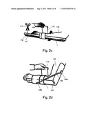 Rollable Compact Transparent Splint diagram and image