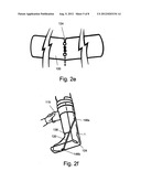 Rollable Compact Transparent Splint diagram and image