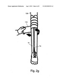 Rollable Compact Transparent Splint diagram and image