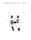 ADJUSTABLE ORTHOSIS FOR ELECTRICAL STIMULATION OF A LIMB diagram and image