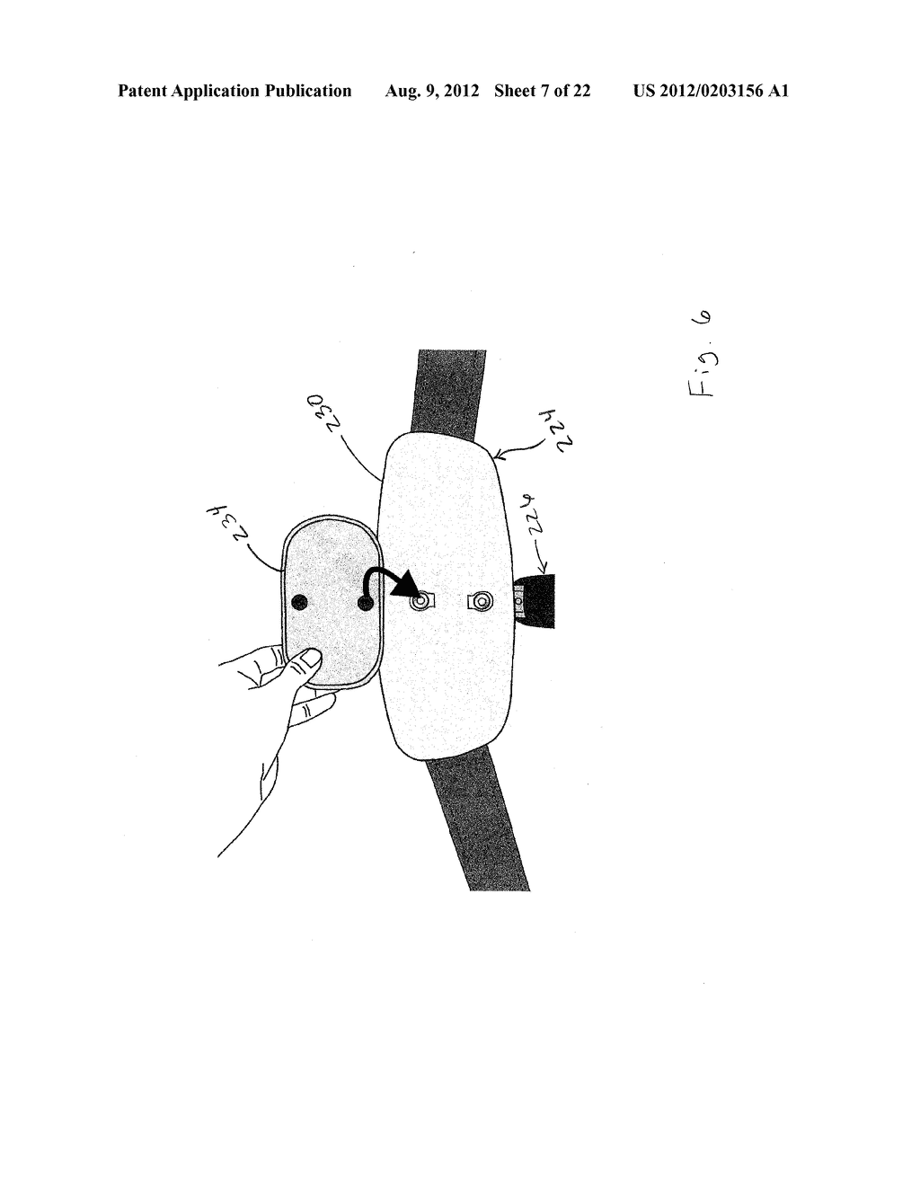 ADJUSTABLE ORTHOSIS FOR ELECTRICAL STIMULATION OF A LIMB - diagram, schematic, and image 08