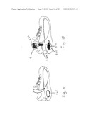 ADJUSTABLE ORTHOSIS FOR ELECTRICAL STIMULATION OF A LIMB diagram and image