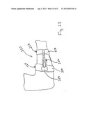 ADJUSTABLE ORTHOSIS FOR ELECTRICAL STIMULATION OF A LIMB diagram and image