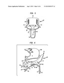 NECK BRACE diagram and image