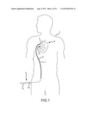 SHAFT AND HANDLE FOR A CATHETER WITH INDEPENDENTLY-DEFLECTABLE SEGMENTS diagram and image