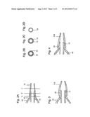 CATHETER HAVING A SOFT DISTAL TIP diagram and image