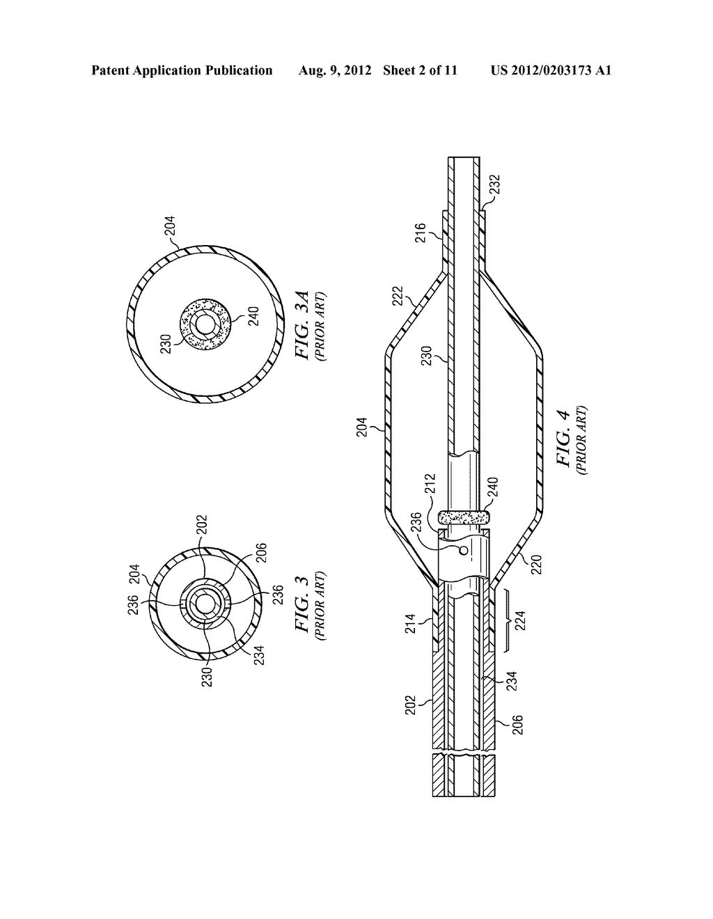 COAXIAL CATHETER SHAFT HAVING BALLOON ATTACHMENT FEATURE WITH AXIAL FLUID     PATH - diagram, schematic, and image 03