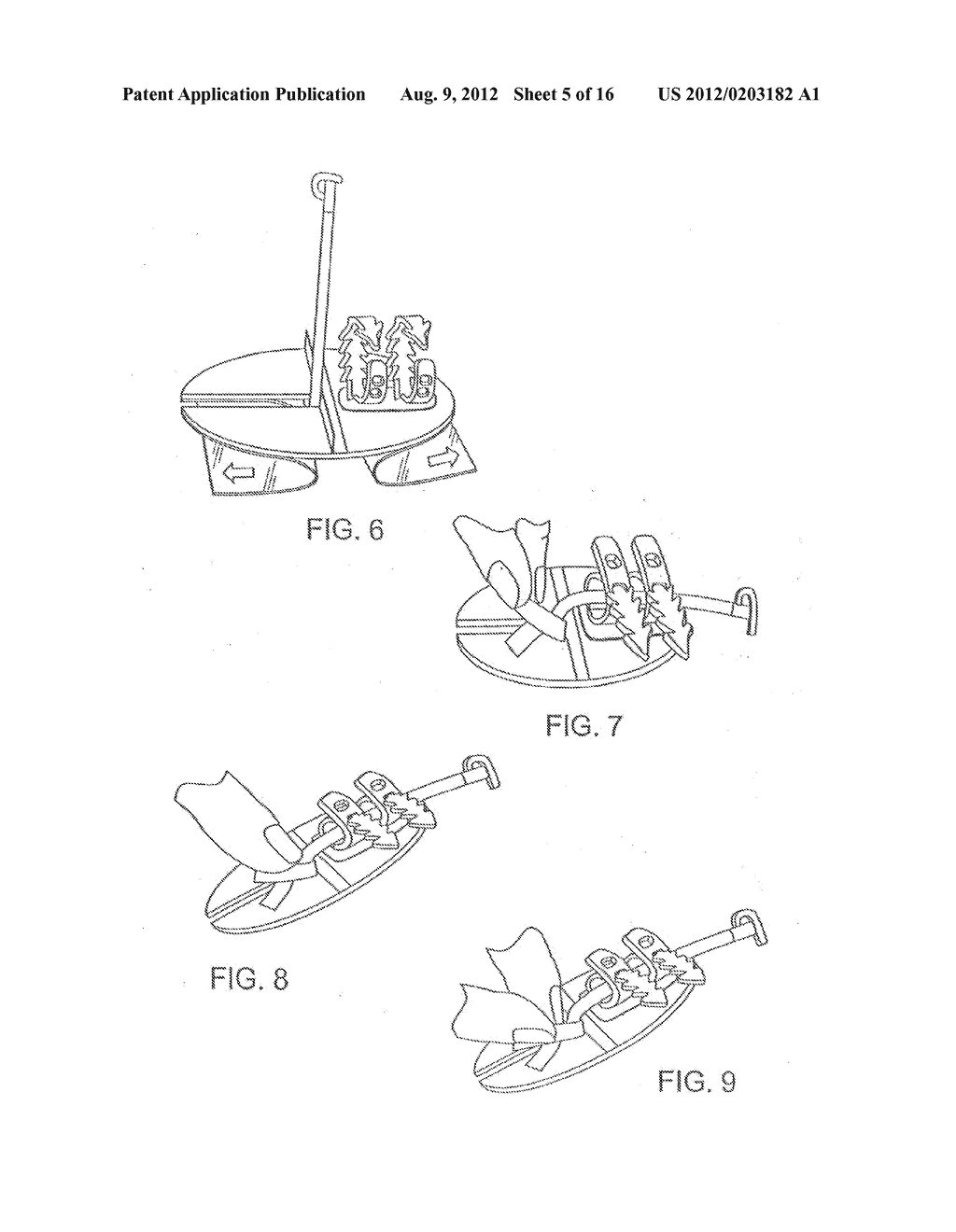 Adhesive layer arrangements and methods for securing medical tubing - diagram, schematic, and image 06