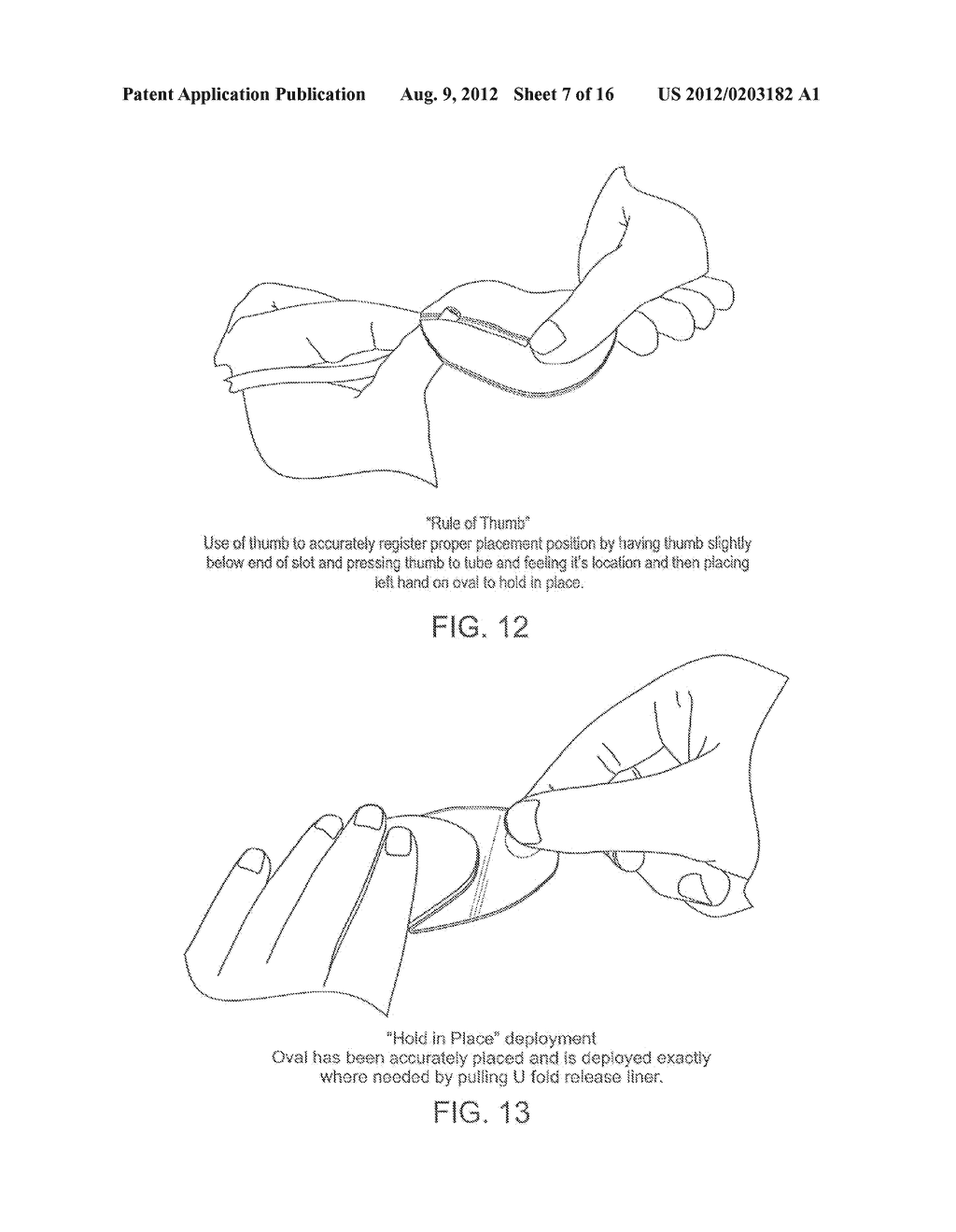 Adhesive layer arrangements and methods for securing medical tubing - diagram, schematic, and image 08