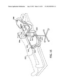 Methods for Preparing a Heat Exchange Catheter System and for Heating     and/or Cooling a Subject s Body diagram and image