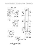 Methods for Preparing a Heat Exchange Catheter System and for Heating     and/or Cooling a Subject s Body diagram and image