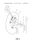 METHOD AND APPARATUS FOR DELIVERING AN AGENT TO A KIDNEY diagram and image