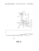 METHOD AND APPARATUS FOR DELIVERING AN AGENT TO A KIDNEY diagram and image