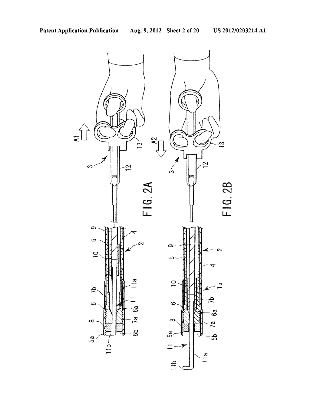 ENDOSCOPIC TREATMENT INSTRUMENT - diagram, schematic, and image 03