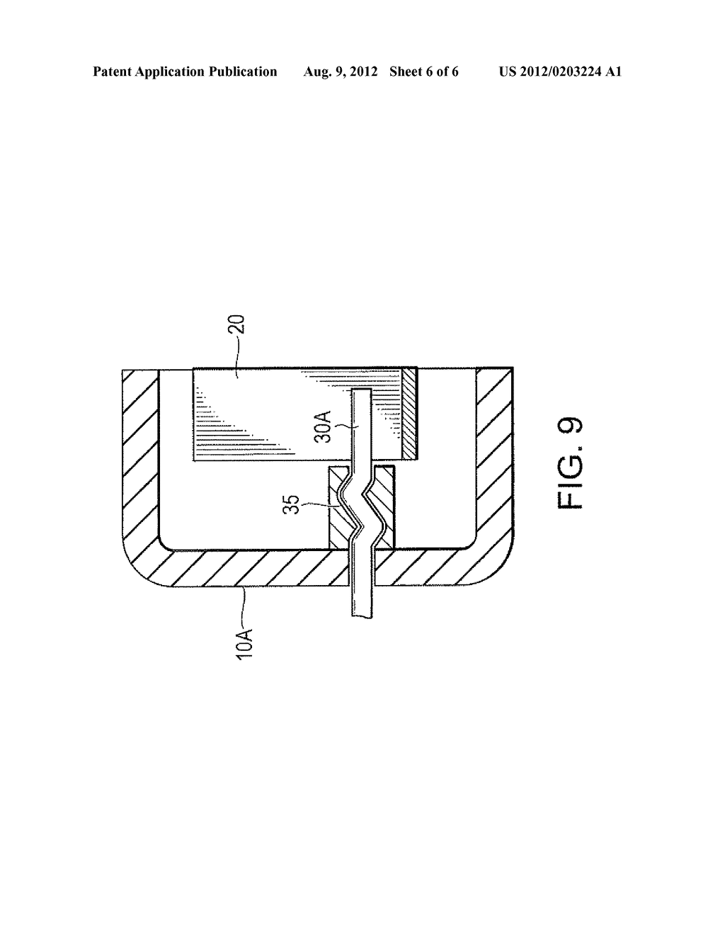 SINGLE-USE ELECTRONIC APPARATUS HAVING A THERMAL SWITCH - diagram, schematic, and image 07