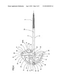 MULTI-PURPOSE EXTERNAL FIXATOR diagram and image