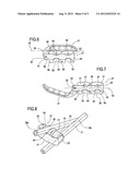 MULTI-PURPOSE EXTERNAL FIXATOR diagram and image