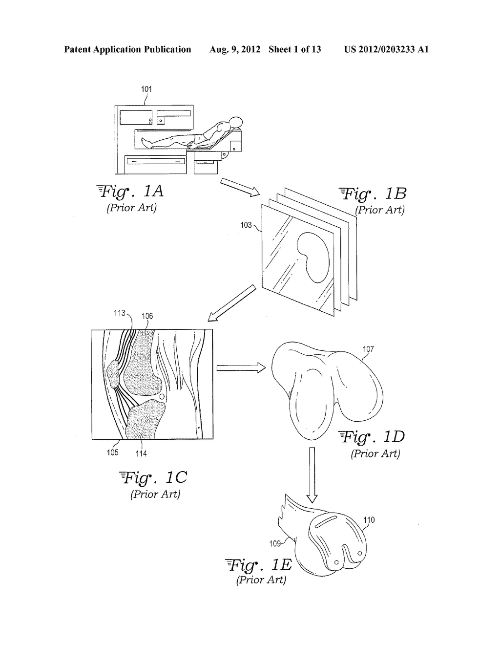 CUSTOM SURGICAL CUTTING BLOCK DESIGN - diagram, schematic, and image 02