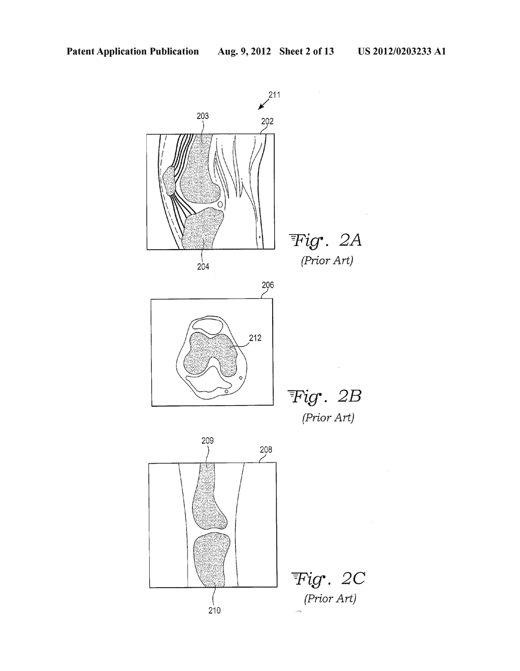 CUSTOM SURGICAL CUTTING BLOCK DESIGN - diagram, schematic, and image 03