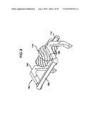 FEMORAL PROSTHETIC IMPLANT diagram and image