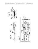 FEMORAL PROSTHETIC IMPLANT diagram and image