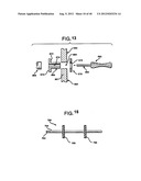 FEMORAL PROSTHETIC IMPLANT diagram and image