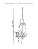 FEMORAL PROSTHETIC IMPLANT diagram and image