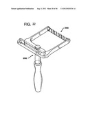 FEMORAL PROSTHETIC IMPLANT diagram and image