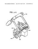 FEMORAL PROSTHETIC IMPLANT diagram and image