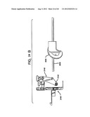 FEMORAL PROSTHETIC IMPLANT diagram and image