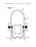 FEMORAL PROSTHETIC IMPLANT diagram and image