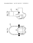 FEMORAL PROSTHETIC IMPLANT diagram and image