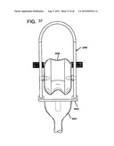 FEMORAL PROSTHETIC IMPLANT diagram and image