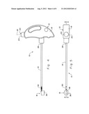 CUFFED-CATHETER REMOVER diagram and image