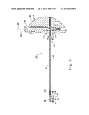 CUFFED-CATHETER REMOVER diagram and image