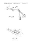 CUFFED-CATHETER REMOVER diagram and image