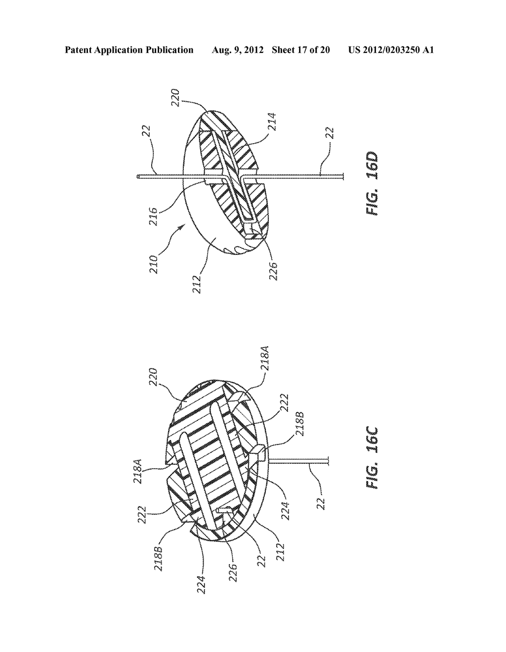 T-Fastener Suture Delivery System - diagram, schematic, and image 18