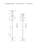 Gastropexy Kit diagram and image