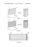 SYSTEM FOR TISSUE FIXATION TO BONE diagram and image