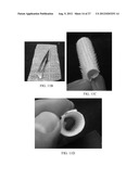 SYSTEM FOR TISSUE FIXATION TO BONE diagram and image